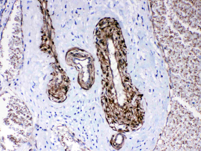 CPI-17 Antibody in Immunohistochemistry (Paraffin) (IHC (P))