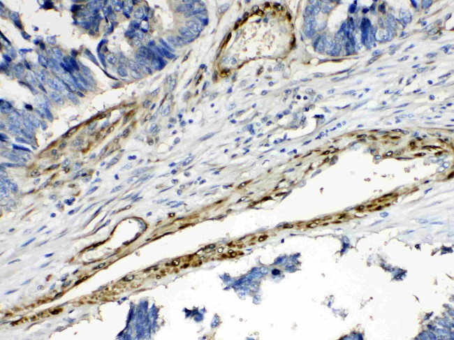 CPI-17 Antibody in Immunohistochemistry (Paraffin) (IHC (P))