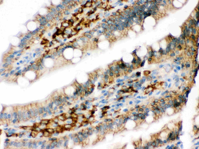 DARPP-32 Antibody in Immunohistochemistry (Paraffin) (IHC (P))