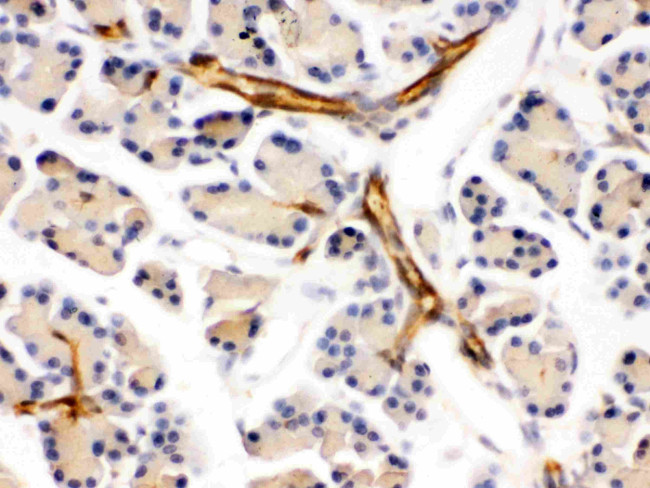 DARPP-32 Antibody in Immunohistochemistry (Paraffin) (IHC (P))