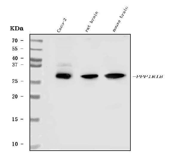 DARPP-32 Antibody in Western Blot (WB)