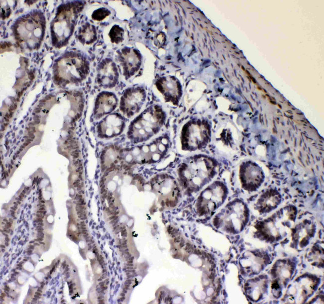 Blimp-1 Antibody in Immunohistochemistry (Paraffin) (IHC (P))