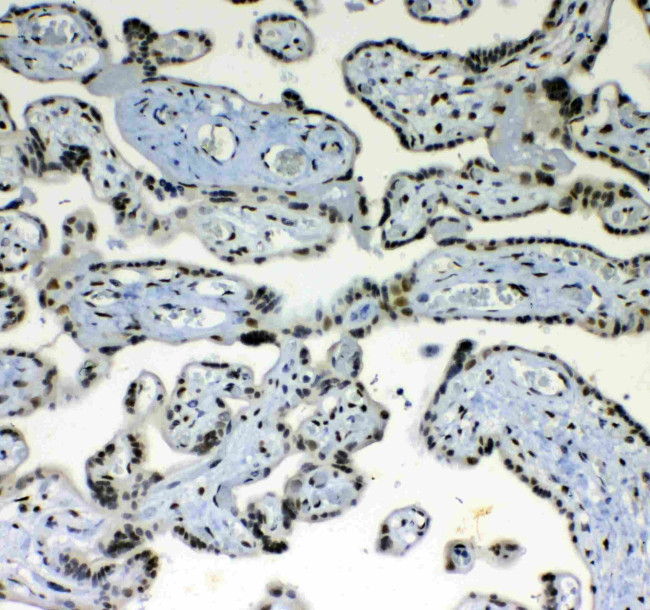 Blimp-1 Antibody in Immunohistochemistry (Paraffin) (IHC (P))