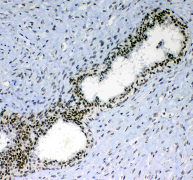 Blimp-1 Antibody in Immunohistochemistry (Paraffin) (IHC (P))