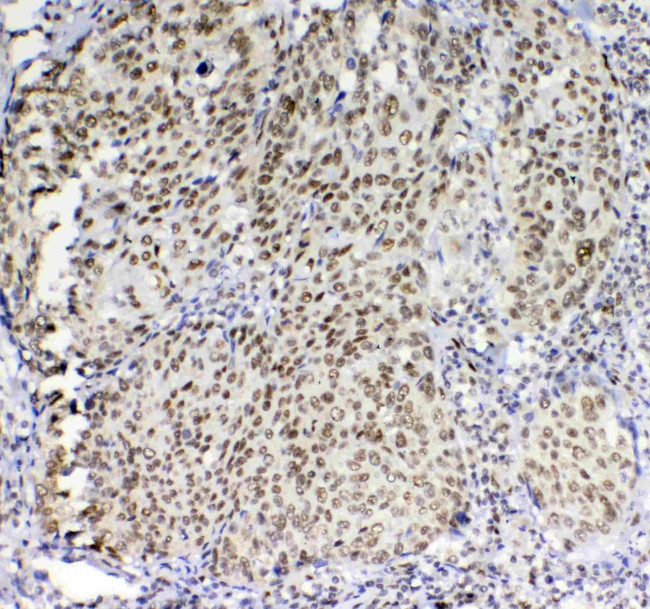 Blimp-1 Antibody in Immunohistochemistry (Paraffin) (IHC (P))