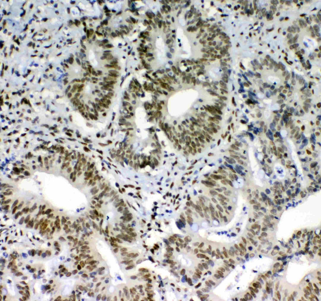 Blimp-1 Antibody in Immunohistochemistry (Paraffin) (IHC (P))