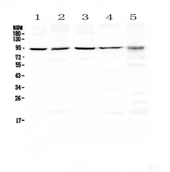 Blimp-1 Antibody in Western Blot (WB)