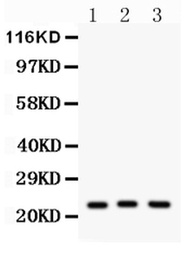 PRDX5 Antibody in Western Blot (WB)