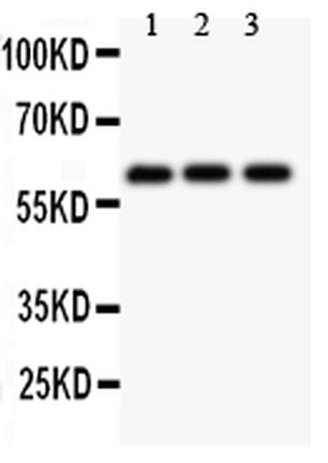 Perforin Antibody in Western Blot (WB)