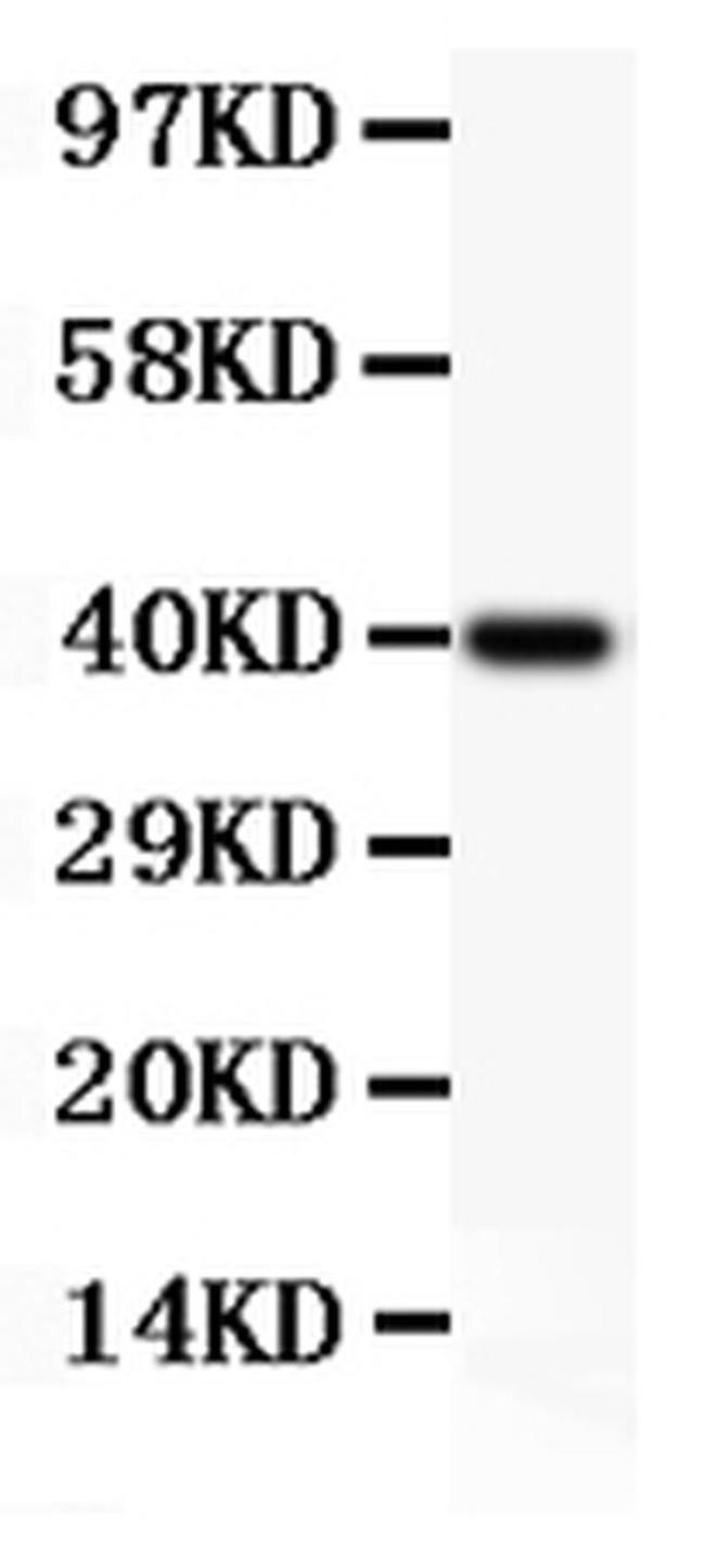 Perforin Antibody in Western Blot (WB)