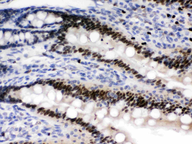 AMPK Beta-2 Antibody in Immunohistochemistry (Paraffin) (IHC (P))