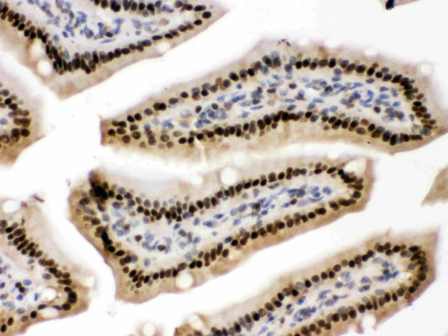 AMPK Beta-2 Antibody in Immunohistochemistry (Paraffin) (IHC (P))