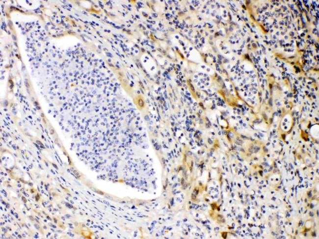 PRKAR1A Antibody in Immunohistochemistry (Paraffin) (IHC (P))