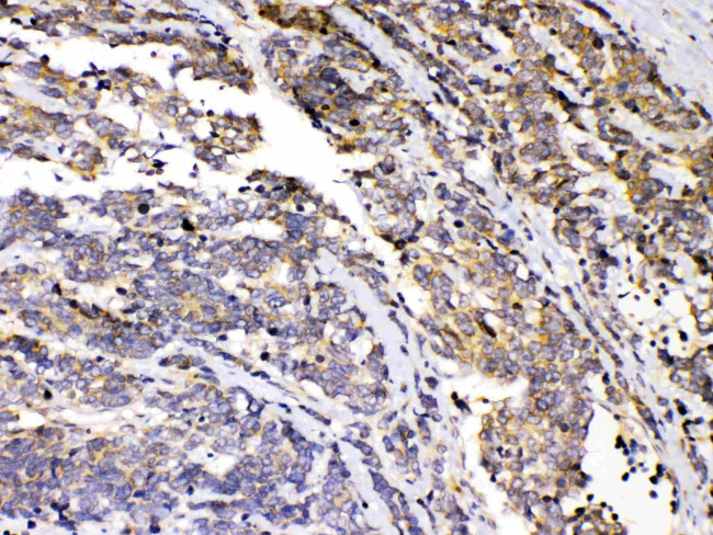 PRKAR1A Antibody in Immunohistochemistry (Paraffin) (IHC (P))