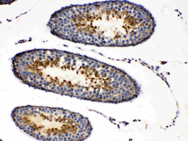 PRKAR1A Antibody in Immunohistochemistry (Paraffin) (IHC (P))