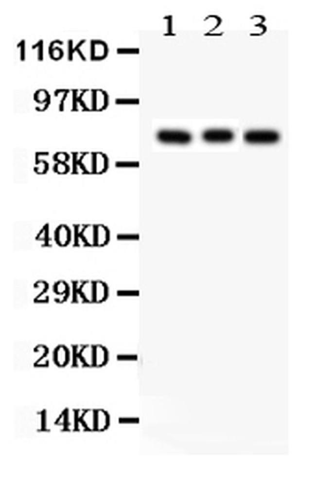 PKC beta-1 Antibody in Western Blot (WB)