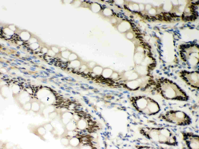 PKC epsilon Antibody in Immunohistochemistry (Paraffin) (IHC (P))