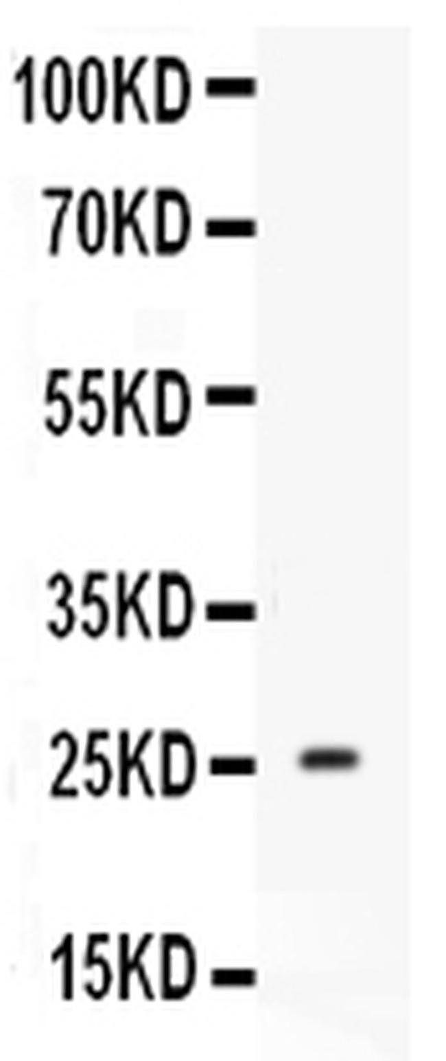 Prolactin Antibody in Western Blot (WB)