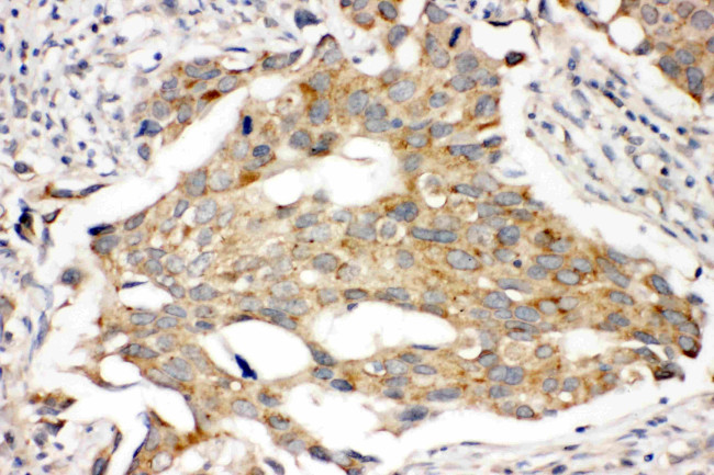 Prolactin Receptor Antibody in Immunohistochemistry (Paraffin) (IHC (P))