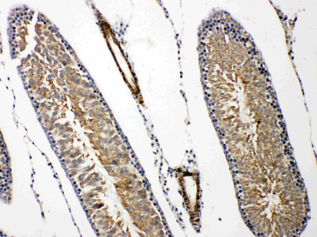 Prolactin Receptor Antibody in Immunohistochemistry (Paraffin) (IHC (P))