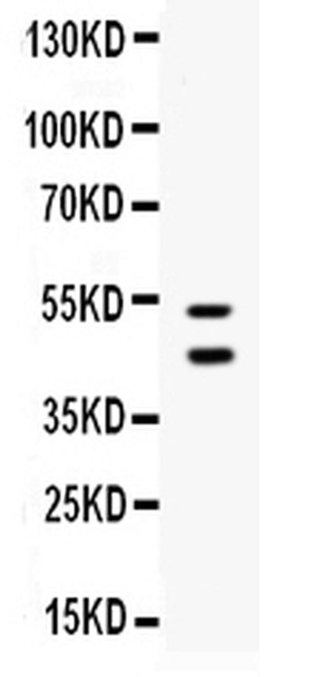 EPCR Antibody in Western Blot (WB)