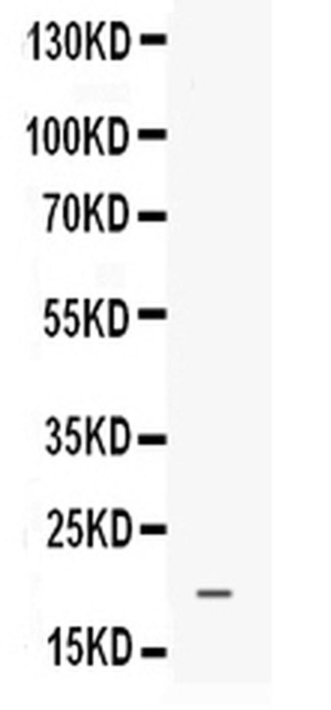 PROK1 Antibody in Western Blot (WB)