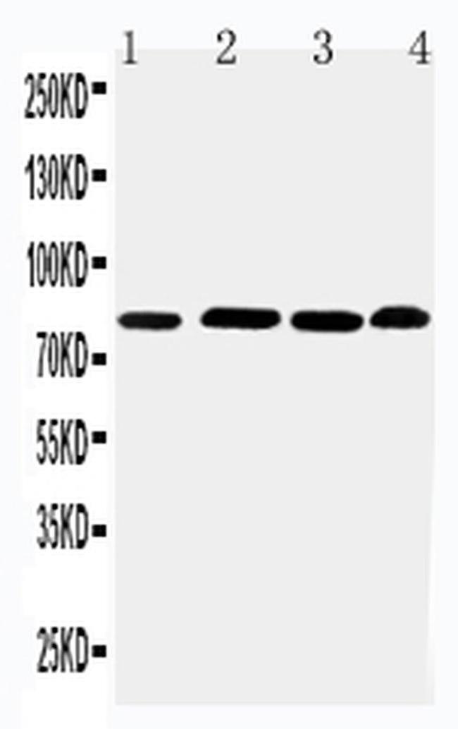 PROX1 Antibody in Western Blot (WB)