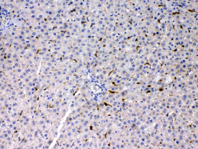 PSAT1 Antibody in Immunohistochemistry (Paraffin) (IHC (P))