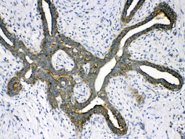 PSAT1 Antibody in Immunohistochemistry (Paraffin) (IHC (P))