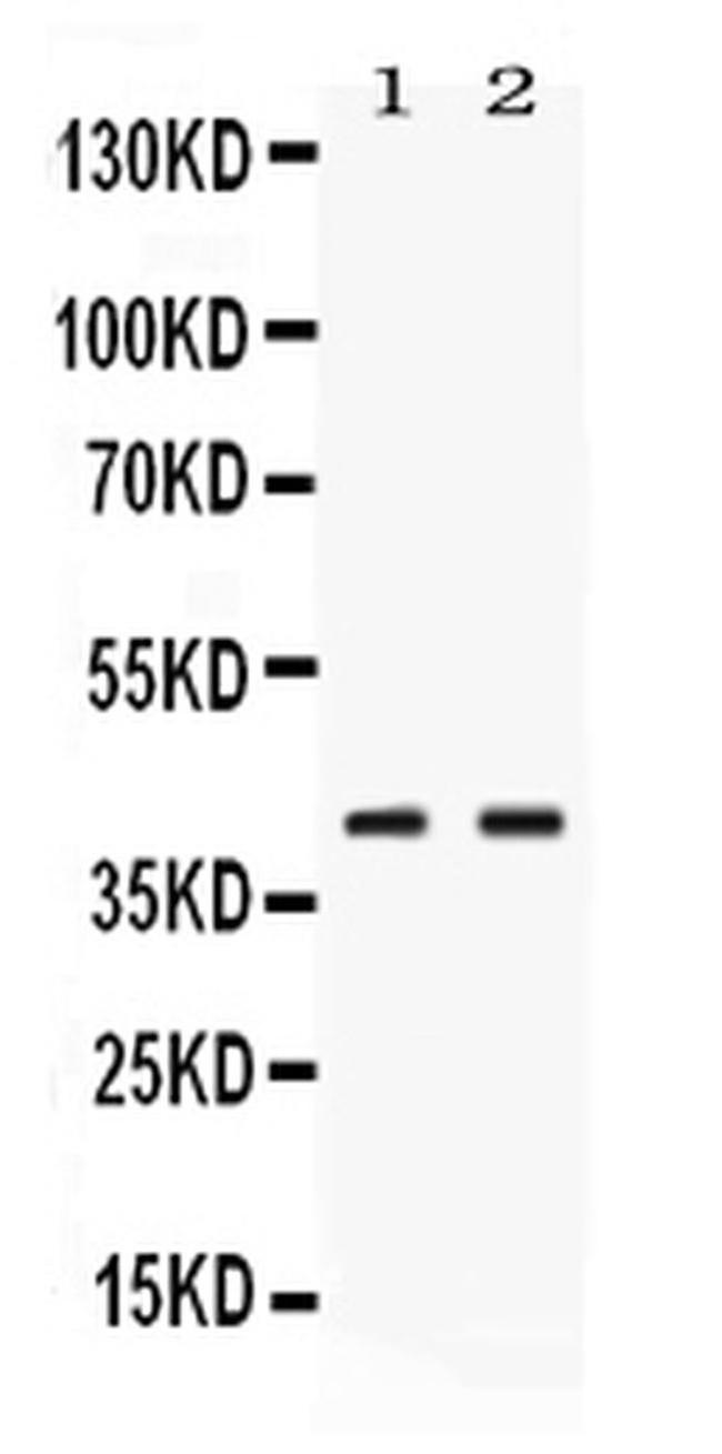 PSAT1 Antibody in Western Blot (WB)