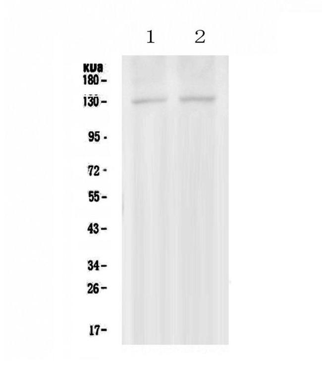 PSD Antibody in Western Blot (WB)