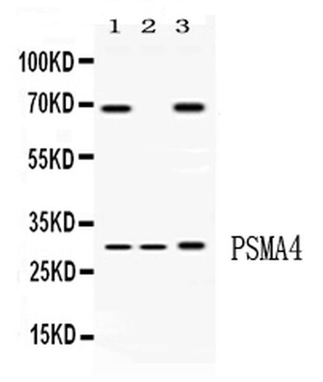 PSMA4 Antibody in Western Blot (WB)