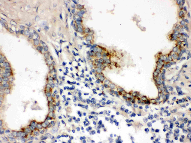 PTP4A2 Antibody in Immunohistochemistry (Paraffin) (IHC (P))