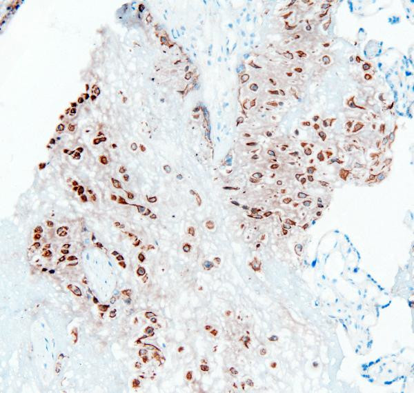 PTP1B Antibody in Immunohistochemistry (Frozen) (IHC (F))