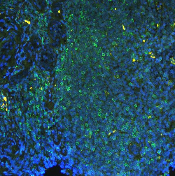 PTP1B Antibody in Immunohistochemistry (Paraffin) (IHC (P))