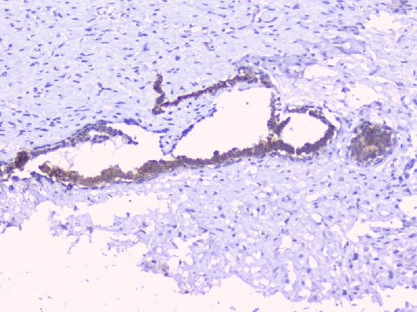 PTP1B Antibody in Immunohistochemistry (Paraffin) (IHC (P))