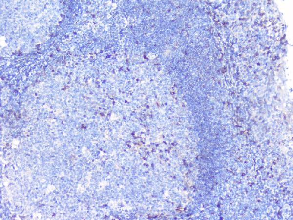 PTP1B Antibody in Immunohistochemistry (Paraffin) (IHC (P))