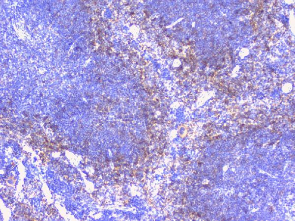 PTP1B Antibody in Immunohistochemistry (Paraffin) (IHC (P))