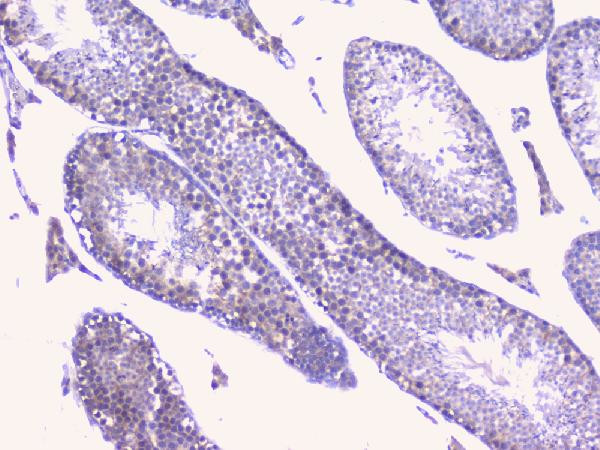 PTP1B Antibody in Immunohistochemistry (Paraffin) (IHC (P))