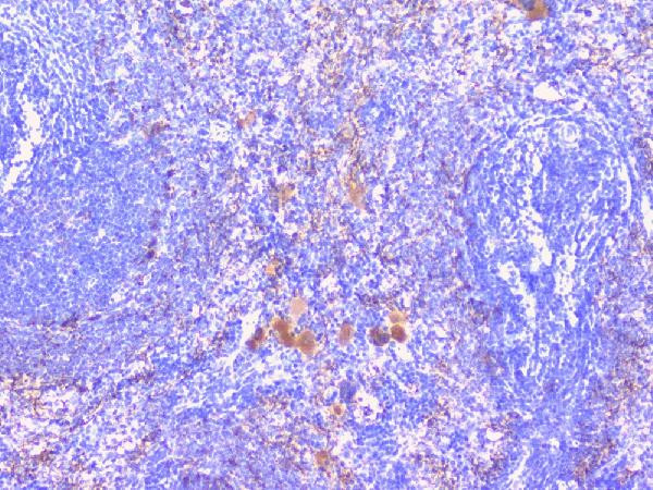 PTP1B Antibody in Immunohistochemistry (Paraffin) (IHC (P))