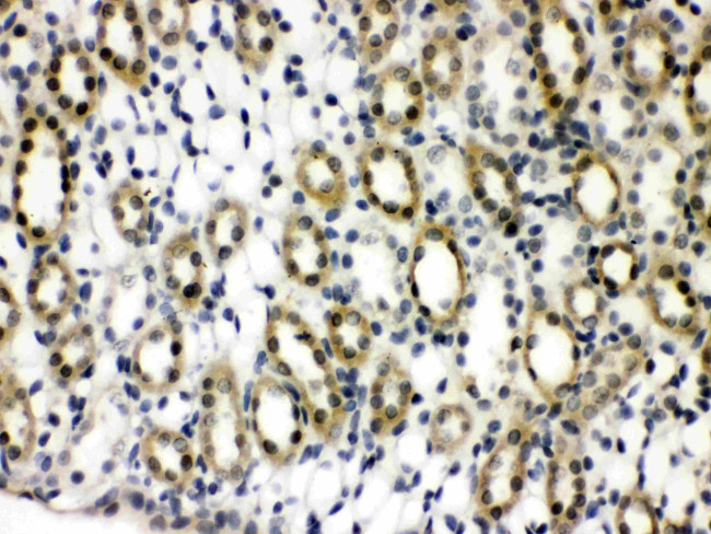 PTPN2 Antibody in Immunohistochemistry (Paraffin) (IHC (P))