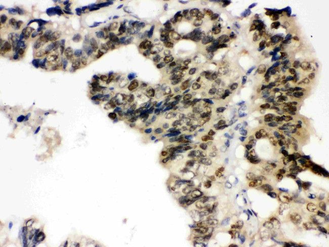 PTPN2 Antibody in Immunohistochemistry (Paraffin) (IHC (P))