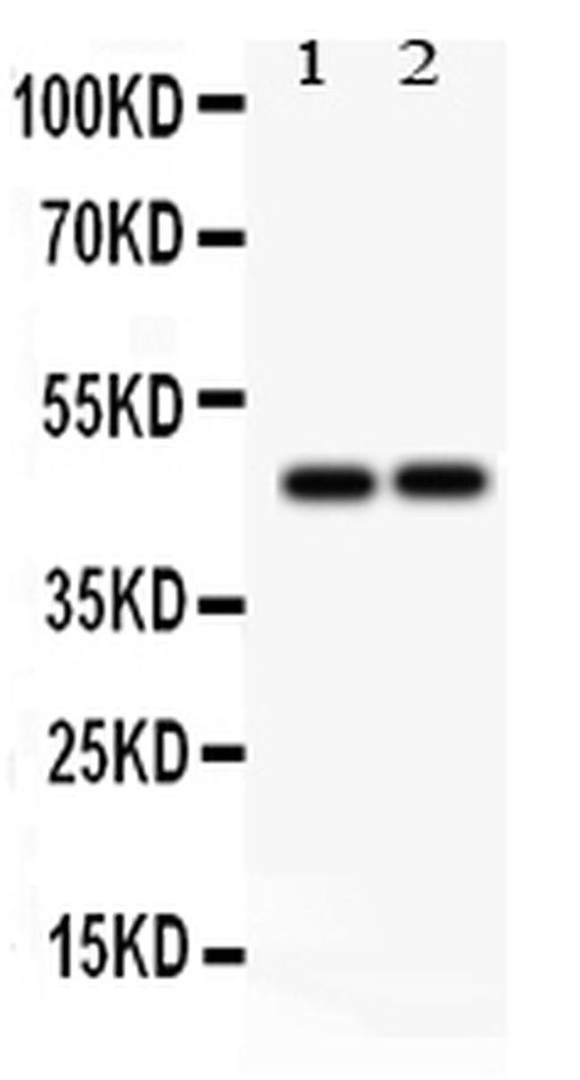 PTPN2 Antibody in Western Blot (WB)