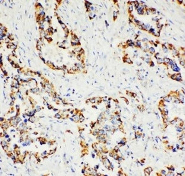 Paxillin Antibody in Immunohistochemistry (Paraffin) (IHC (P))