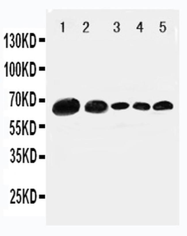 Paxillin Antibody in Western Blot (WB)