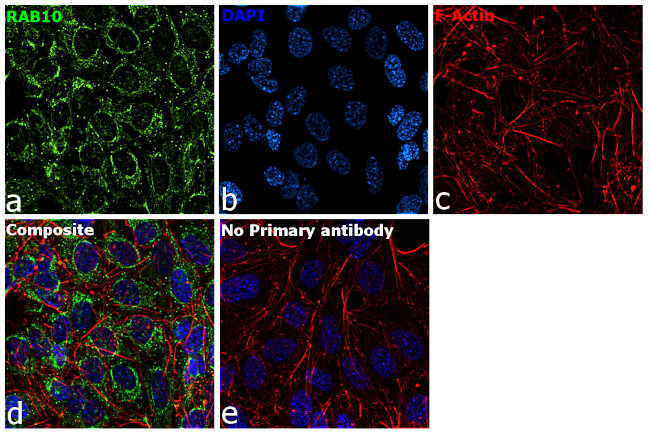 RAB10 Antibody in Immunocytochemistry (ICC/IF)