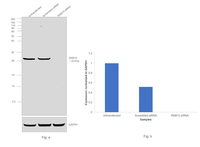 RAB10 Antibody