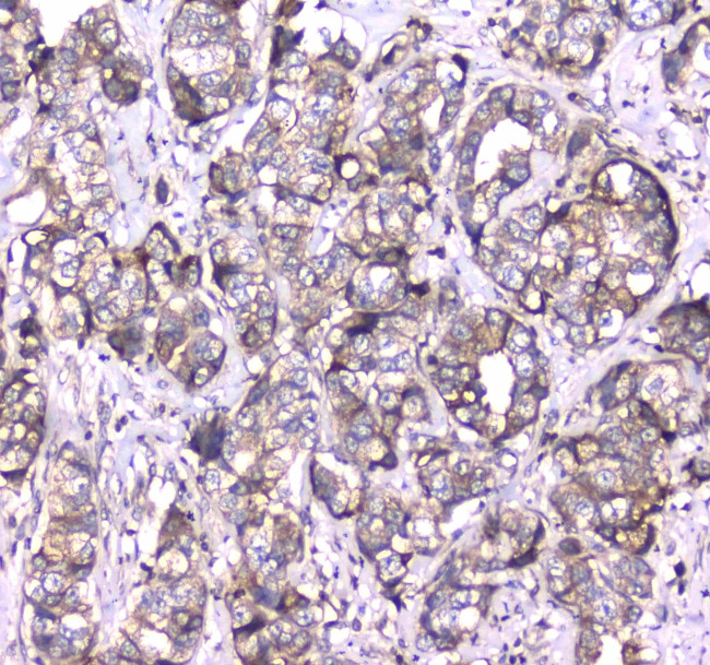 RAB27A Antibody in Immunohistochemistry (Paraffin) (IHC (P))