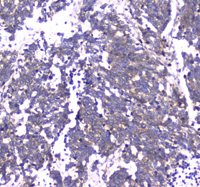 RAB27A Antibody in Immunohistochemistry (Paraffin) (IHC (P))