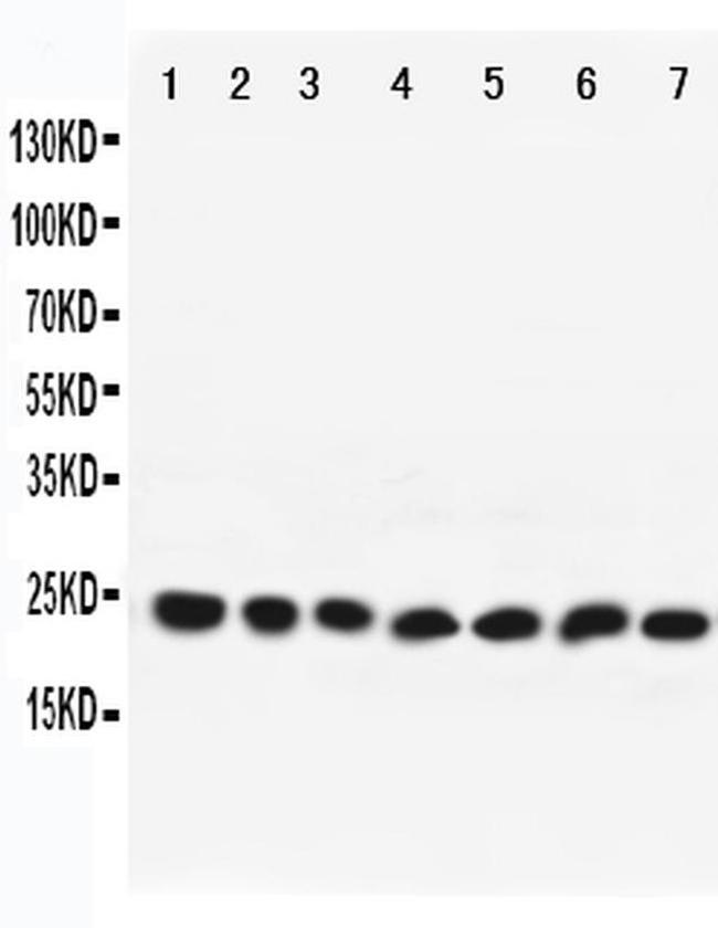 RAB9 Antibody in Western Blot (WB)